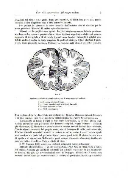 Rivista di patologia nervosa e mentale