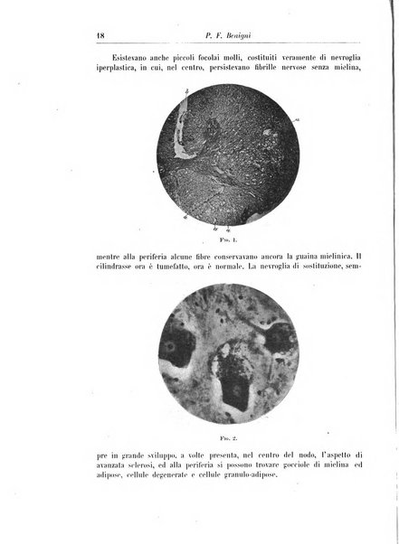 Rivista di patologia nervosa e mentale