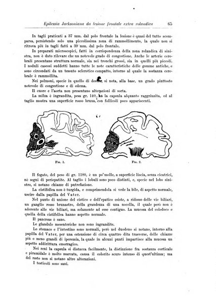 Rivista di patologia nervosa e mentale