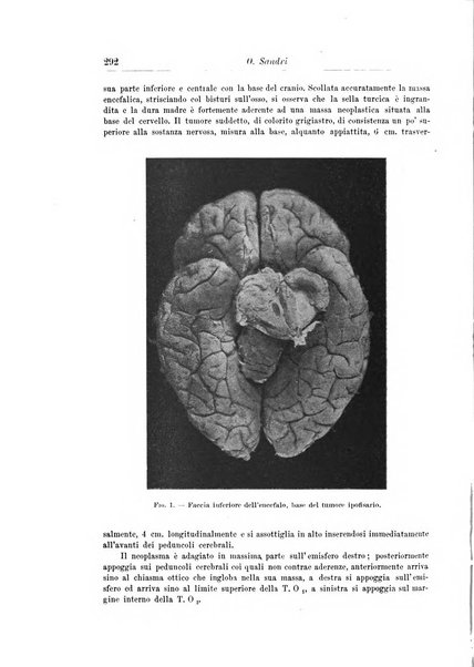 Rivista di patologia nervosa e mentale