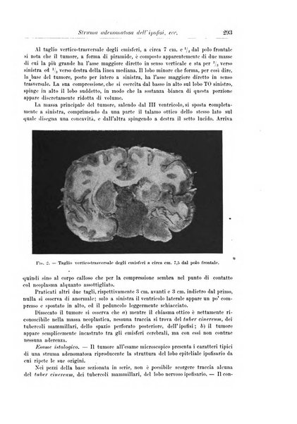 Rivista di patologia nervosa e mentale