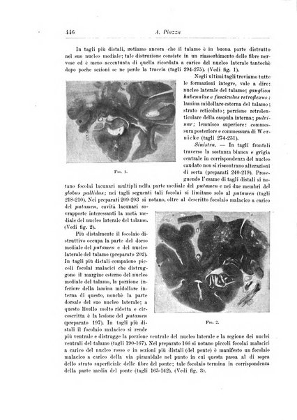 Rivista di patologia nervosa e mentale