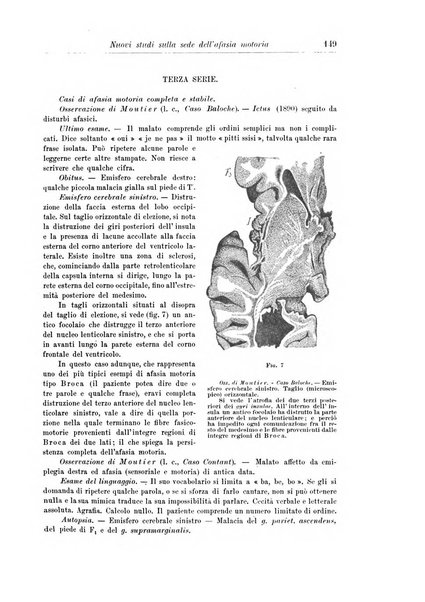 Rivista di patologia nervosa e mentale