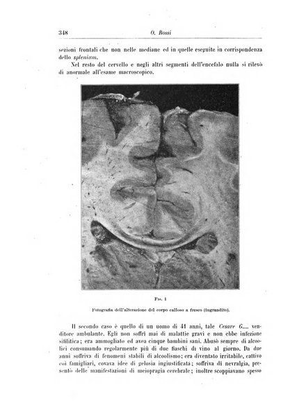 Rivista di patologia nervosa e mentale