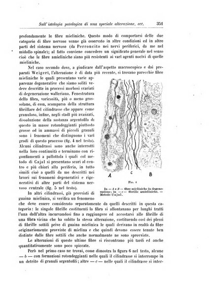 Rivista di patologia nervosa e mentale