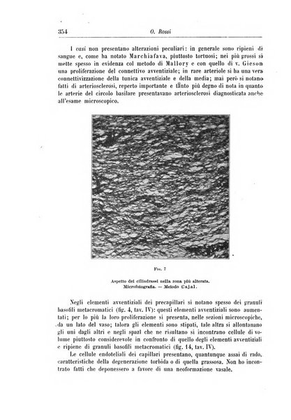 Rivista di patologia nervosa e mentale