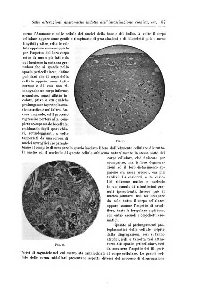 Rivista di patologia nervosa e mentale