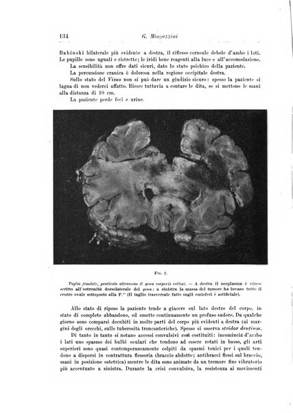 Rivista di patologia nervosa e mentale