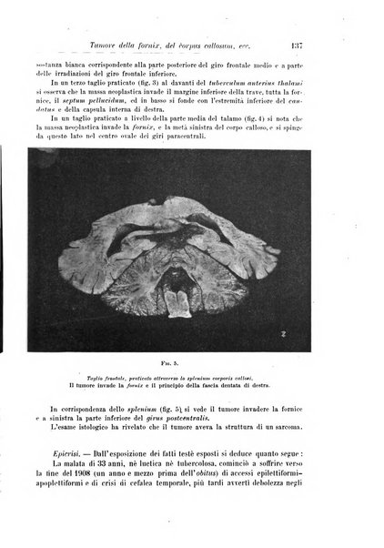 Rivista di patologia nervosa e mentale