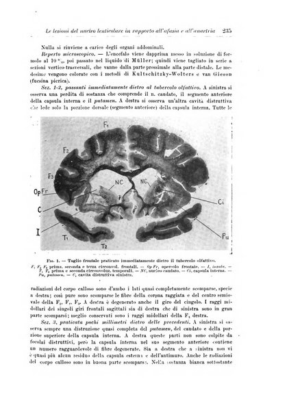 Rivista di patologia nervosa e mentale