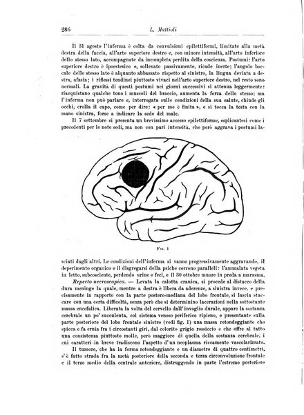 Rivista di patologia nervosa e mentale