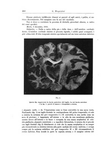 Rivista di patologia nervosa e mentale