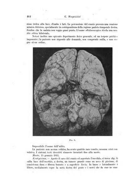 Rivista di patologia nervosa e mentale