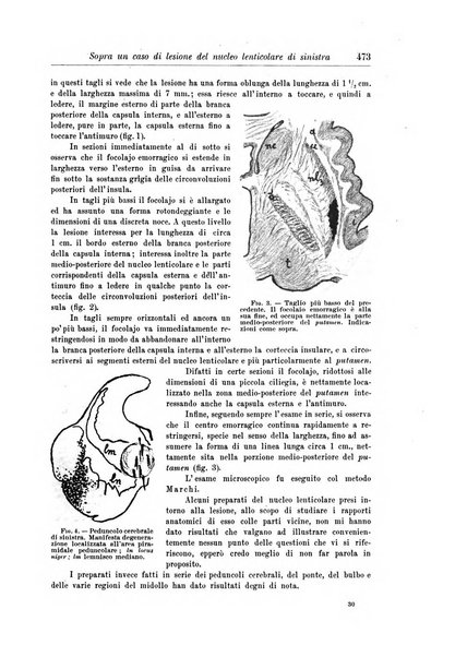 Rivista di patologia nervosa e mentale