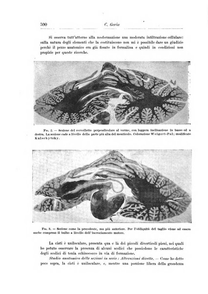 Rivista di patologia nervosa e mentale