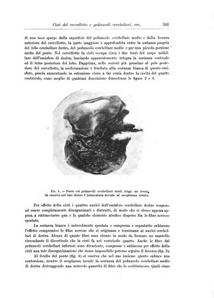 Rivista di patologia nervosa e mentale