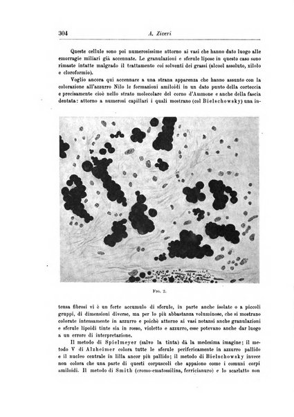 Rivista di patologia nervosa e mentale