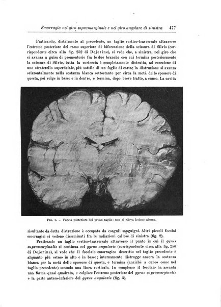 Rivista di patologia nervosa e mentale