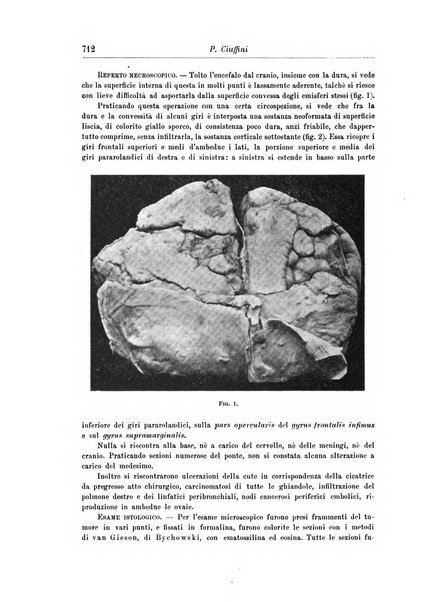 Rivista di patologia nervosa e mentale