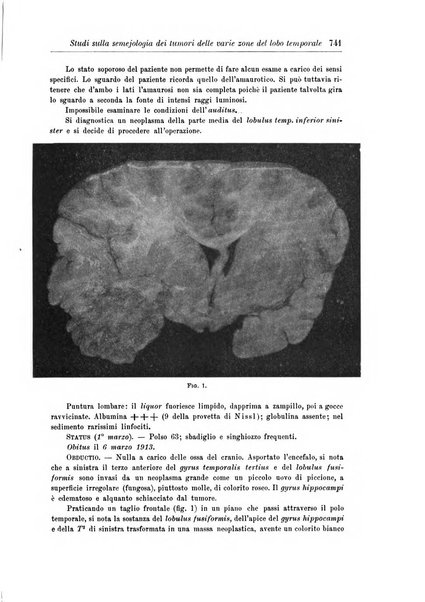 Rivista di patologia nervosa e mentale