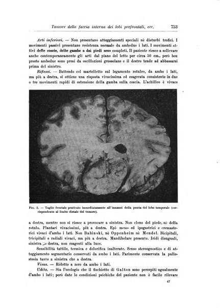 Rivista di patologia nervosa e mentale