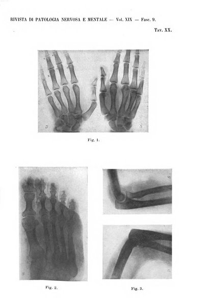 Rivista di patologia nervosa e mentale