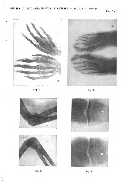 Rivista di patologia nervosa e mentale