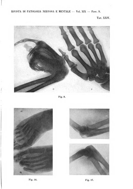 Rivista di patologia nervosa e mentale