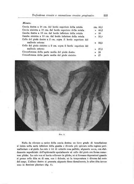 Rivista di patologia nervosa e mentale