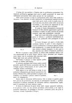 giornale/CFI0298588/1915/unico/00000190