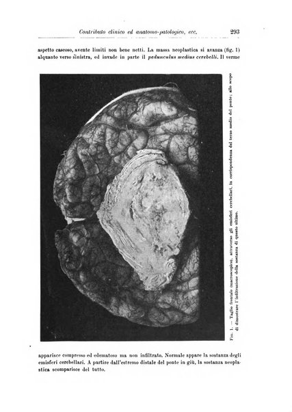 Rivista di patologia nervosa e mentale