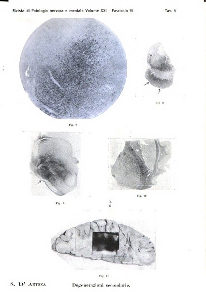 Rivista di patologia nervosa e mentale