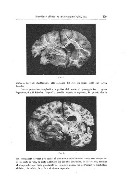 Rivista di patologia nervosa e mentale