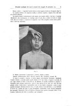 giornale/CFI0298588/1918/unico/00000011