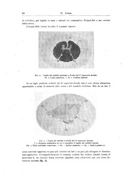 Rivista di patologia nervosa e mentale