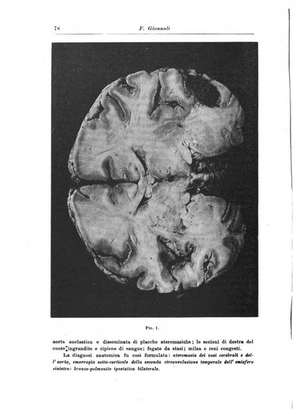 Rivista di patologia nervosa e mentale