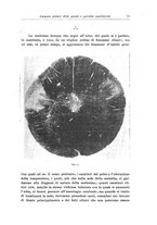 giornale/CFI0298588/1918/unico/00000089