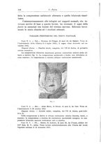 giornale/CFI0298588/1918/unico/00000160