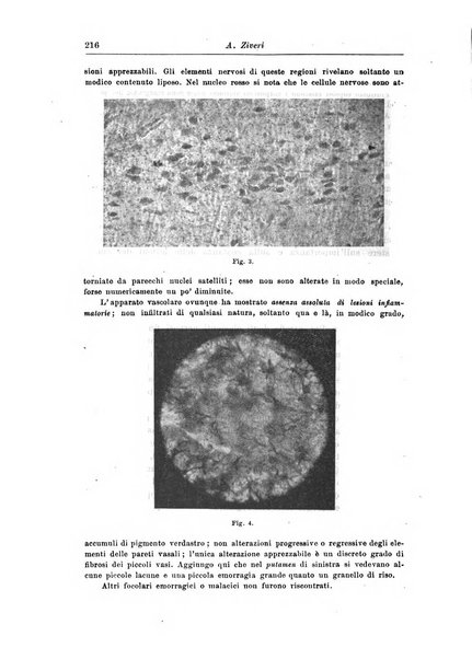 Rivista di patologia nervosa e mentale