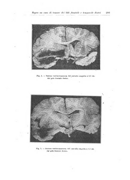 Rivista di patologia nervosa e mentale