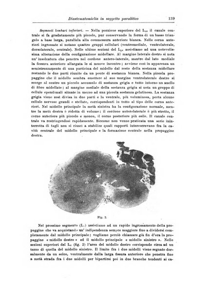 Rivista di patologia nervosa e mentale