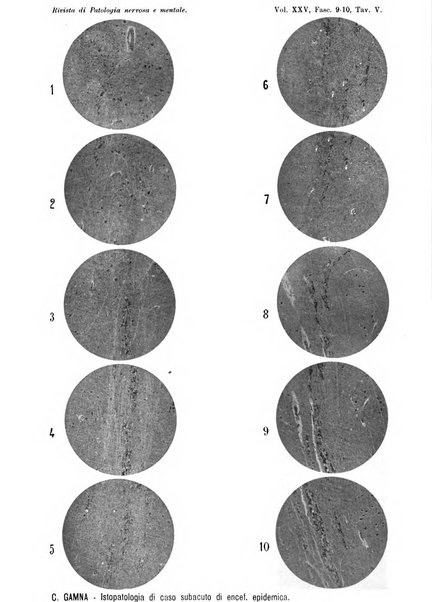 Rivista di patologia nervosa e mentale