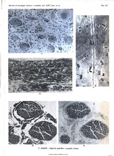 Rivista di patologia nervosa e mentale