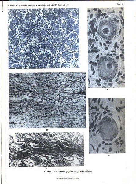 Rivista di patologia nervosa e mentale