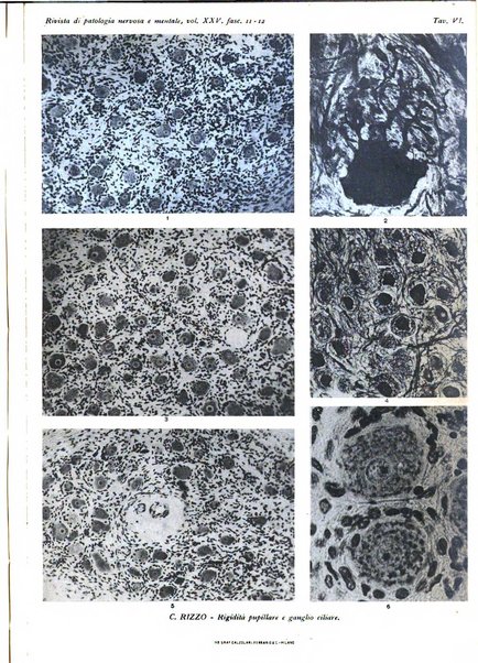 Rivista di patologia nervosa e mentale