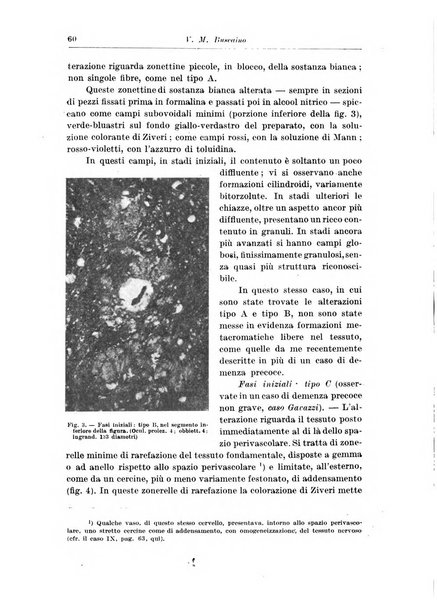 Rivista di patologia nervosa e mentale