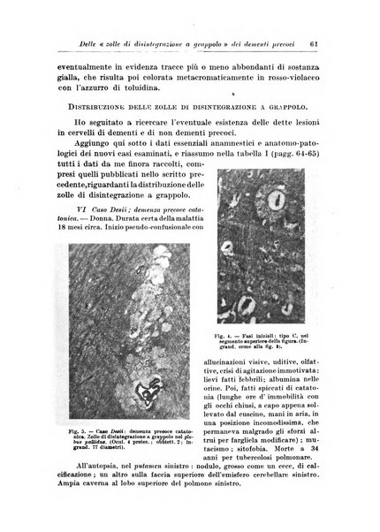 Rivista di patologia nervosa e mentale