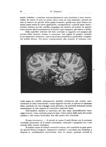 Rivista di patologia nervosa e mentale