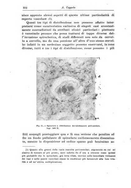 Rivista di patologia nervosa e mentale