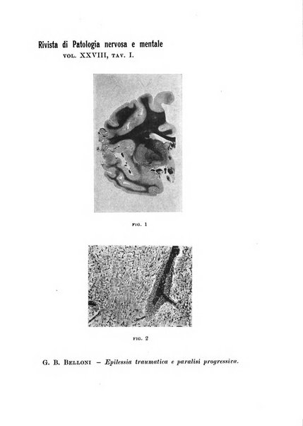 Rivista di patologia nervosa e mentale